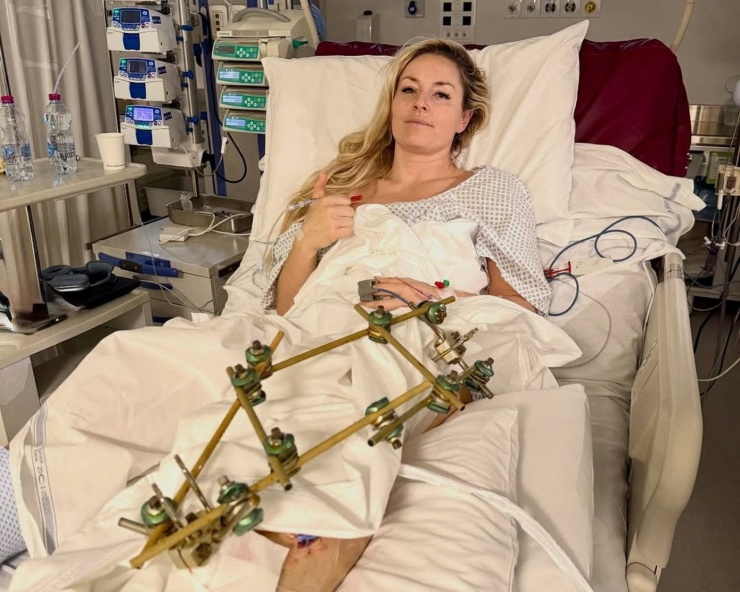 Lindsey Vonn đang phải dùng nẹp cố định vết thương